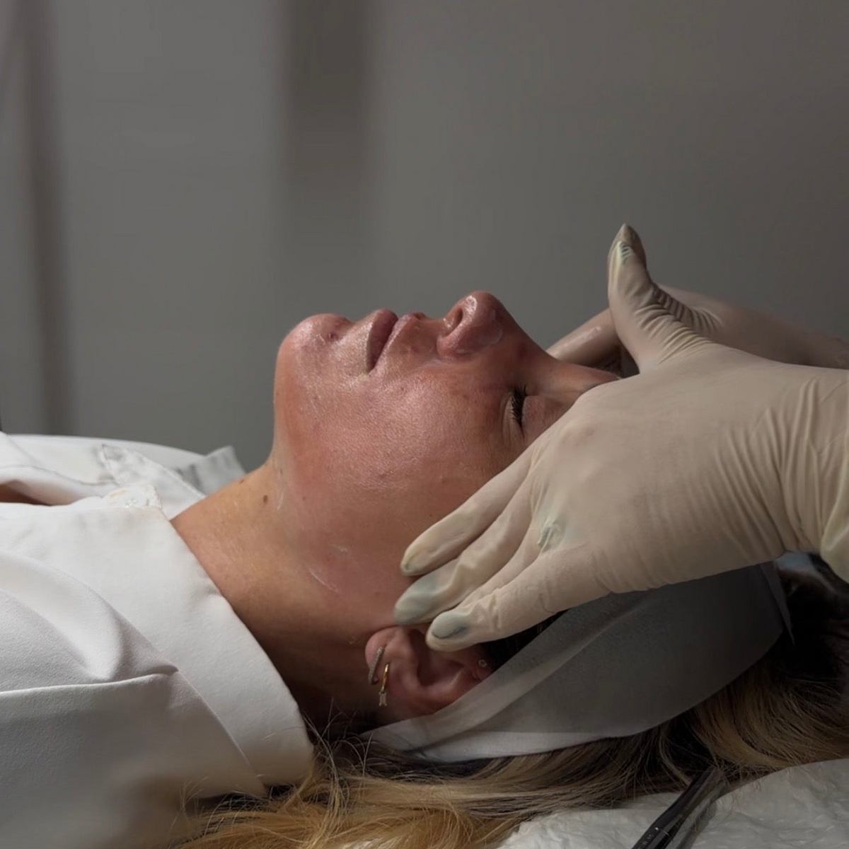 CosmoMed Signature Facial Glow