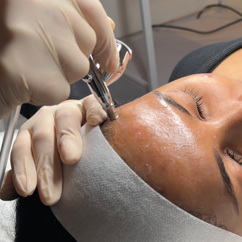 Oxygen Rejuvenation