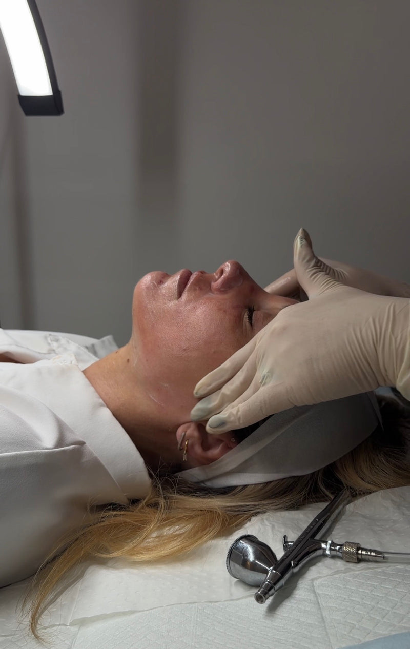 Clinical Peels